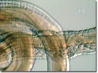 Whipworm
