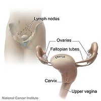 Recovery Time After a Hysterectomy