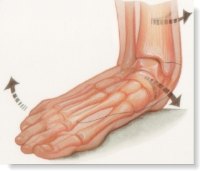Flat Feet & Leg Pain