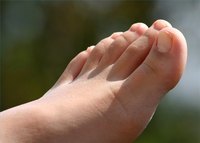 Toe Fungus