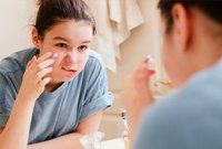 Cure Pimples at Home