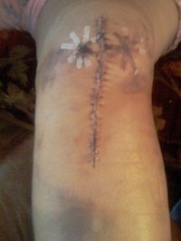 Major knee surgery.