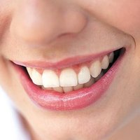 Healthy gums