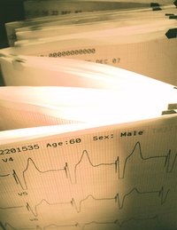 EKGs are used in the diagnosis of hyperkalemia.