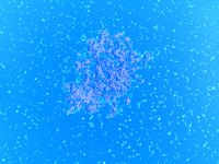 Serratia bacteria can cause hospital outbreaks.