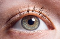 Healthy sclera is primarily white, but may have other color changes that are normal as well.