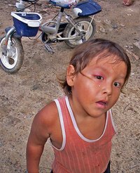 Mitochondrial diseases primarily affect children.