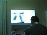 Nebulizers and oxygen treat lungs and heart, but in different ways.