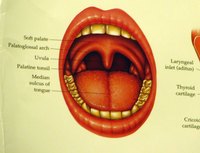 Adenoids are small germ-fighting glands in the back of the throat.