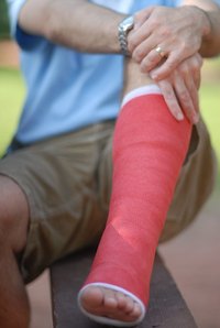 Orthopedists help fix broken bones.