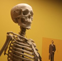 Calcium deposits can harden the bones and tissue.
