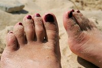 Both bunions and arthritis can cause toe deformity.