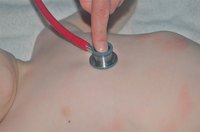 Most rashes are red and often include an itching or burning feeling.