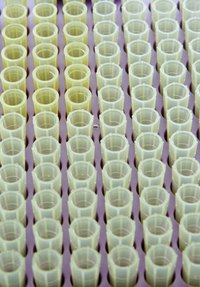 Elevated alkaline phosphatase can indicate liver or bone problems.