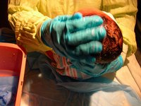Midwives are skilled health care professionals that deliver babies.
