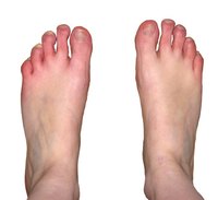 Foot problems can be a sign of heart disease.