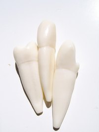 Flippers are partial dentures designed to replace missing teeth.