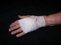 A chemical burn needs immediate attention.
