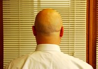 There are many different conditions or problems associated with the scalp.