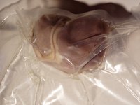 Kidney failure and disease can cause ulcers.