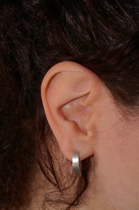 A mole on the ear could mean cancer.