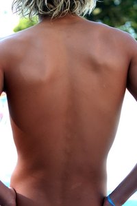 We have lymph nodes all over our bodies.
