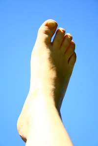 The joint at the base of the big toe is a common location for gout.