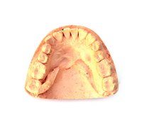 Denture technicians make, alter and repair dentures.