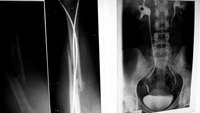 X-rays diagnose everything from simple fractures to complex spinal trauma.