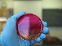 Bacteria in a petri dish is shown.