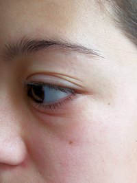 Puffy eyes can make you look tired.