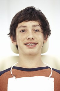 Applying and removing braces are two of the most common procedures performed by orthodontists.