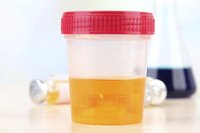 Urine sample