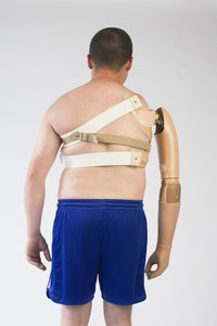 Now you can make your own prosthetic arm model.