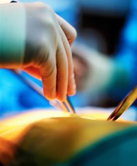Seromas are normal after surgeries, but must be watched carefully to prevent infection.