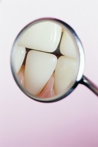Tooth enamel is the visible part of your teeth.
