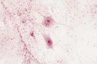 Molecular changes in neurotransmission are responsible for denervation supersensitivity.