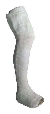 A fake leg cast allows an actor to have a realistic broken leg.