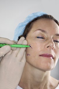 Estheticians encounter clients who need plastic surgery for many different conditions.