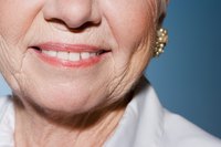Aging and UV exposure cause deep facial wrinkles.