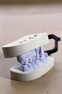 Use a mouth guard as a mold for your plaster.