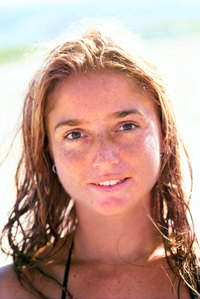 Freckles are more prevalent when skin has been out in the sun.