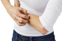 Homemade itching powder produces mild to medium skin irritation.