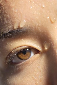 Excessive sweating can be an embarrassing problem.