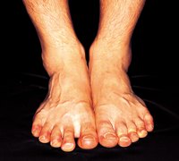 Toes, as the leading edge of your foot, are prone to injury.