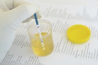 Close-up of urine sample.