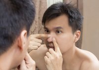 Squeezing pimples can result in inflammation and scarring.