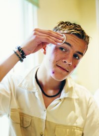 Proper hygiene may not be enough to help pimples heal quickly.