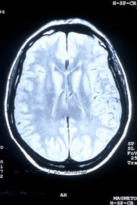 Neuroscience majors study the brain.