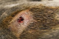 Some sores occur in conjunction with fluid-filled abscesses.